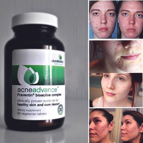 правила использования acneadvance